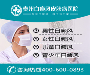 黔南白癜风医院